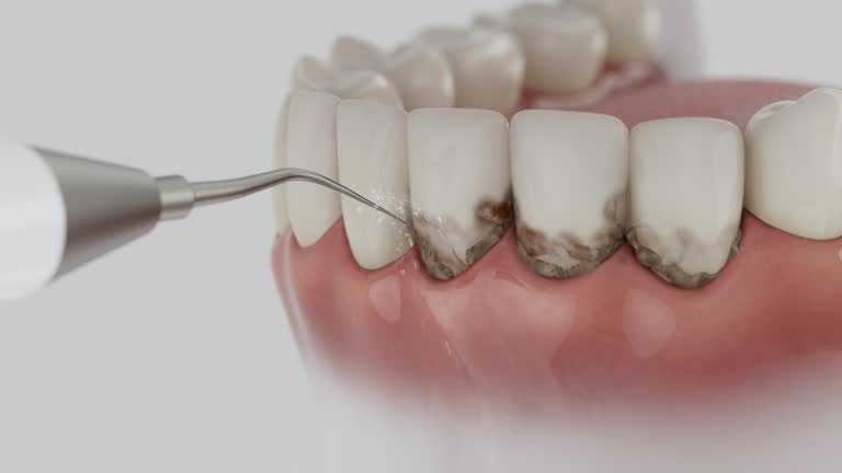 Trusted Dental Implants service in Leonardo, NJ - Dentist Open Now